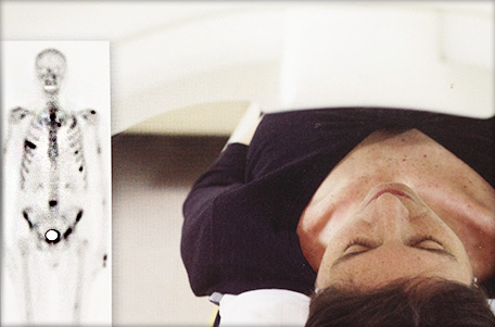 Сцинтиграфия